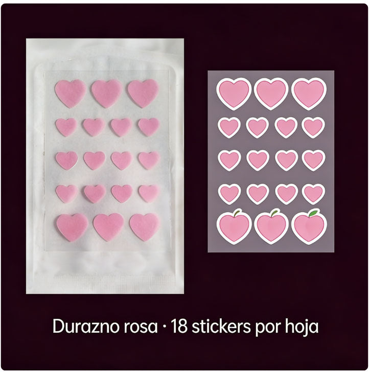 AliExpress In-Stock Cartoon Pimple Patches Cute Cat Paw Ice Cream pe Acne Covering Patch Portable Shaped Acne Clearing Patch Wholesale